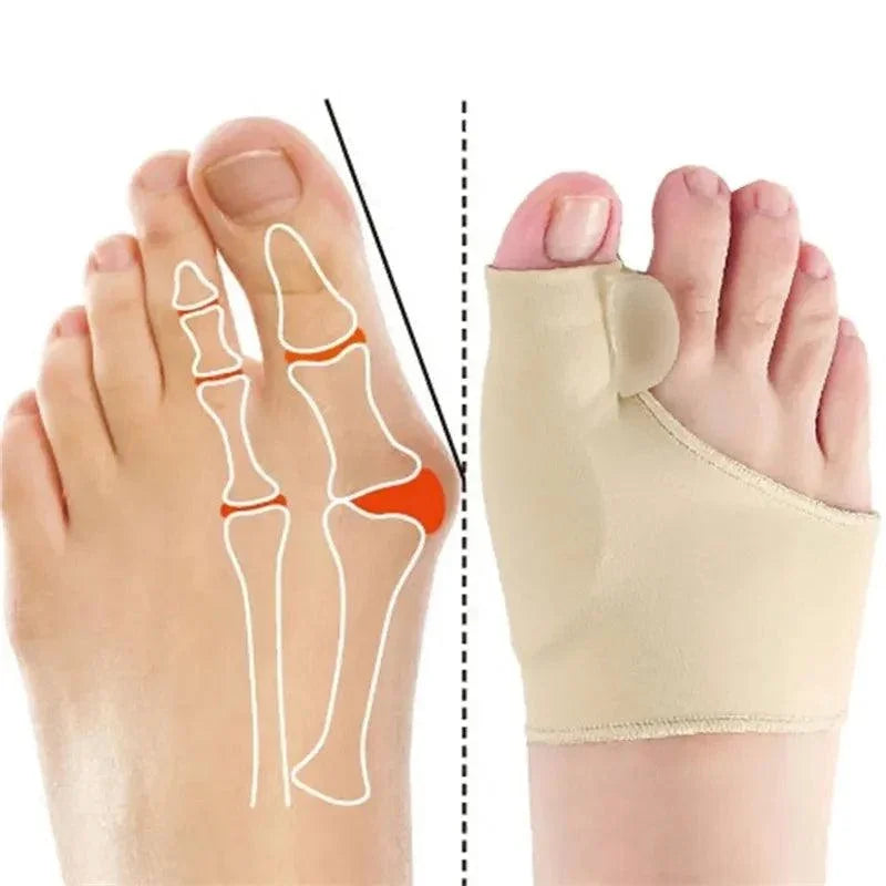 VEONESS™ Funda Ortopédica Diurna para Juanetes