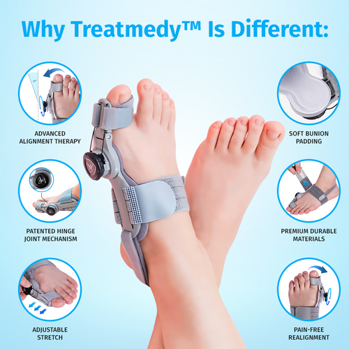 bunion fix features including patented hinge mechanism and adjustable stretch