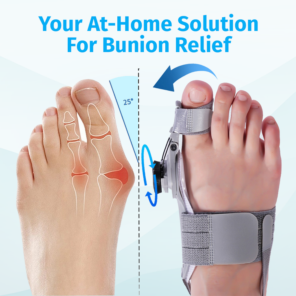 bunion corrector device showing before and after toe alignment on foot
