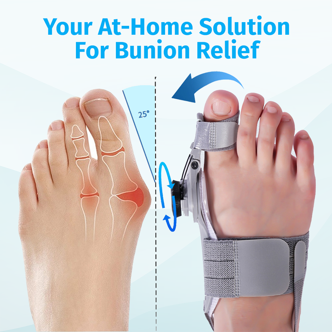 bunion corrector device showing before and after toe alignment on foot
