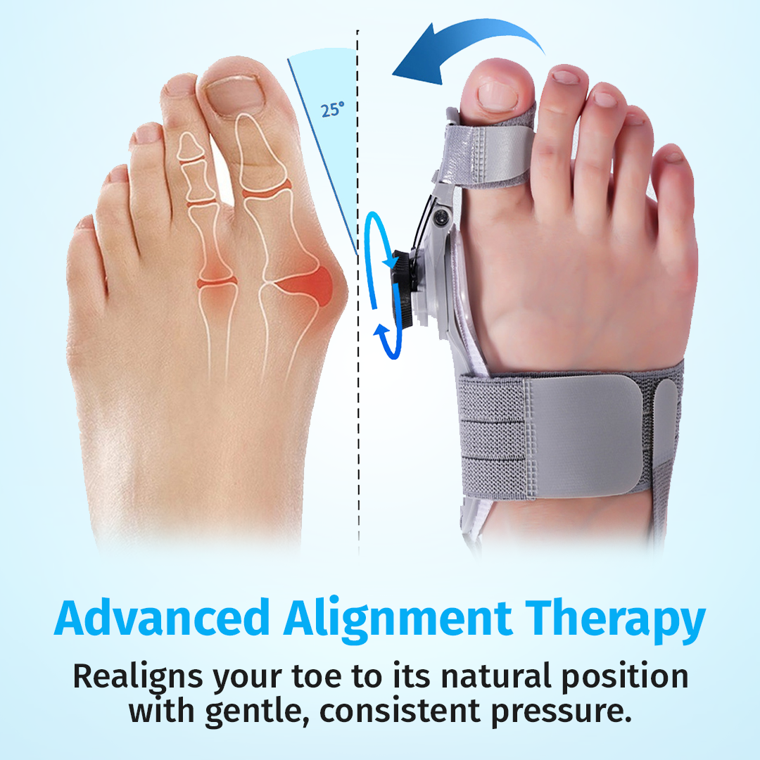 advanced alignment therapy showing toe realignment with bunion corrector